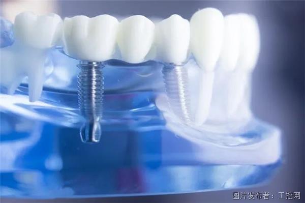 技术方案 如何实现种植牙高效检测？齿科奇招看这篇
