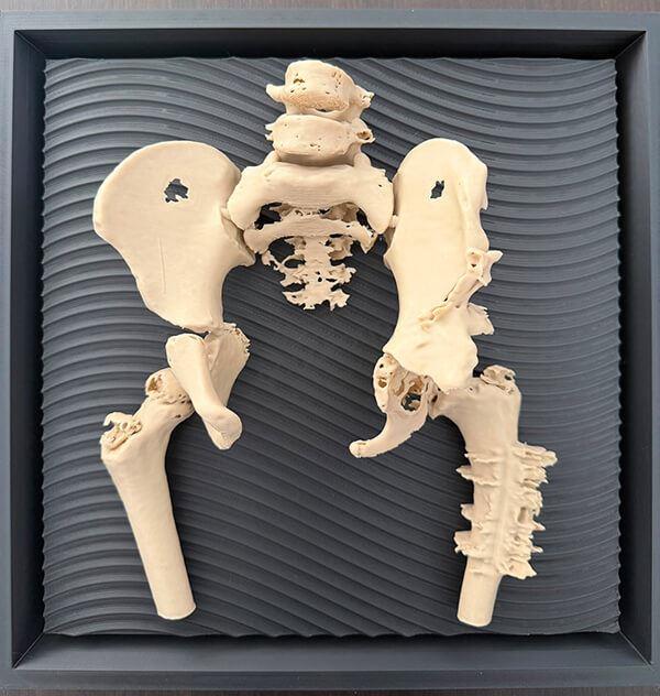 3D打印骨科解剖模型.jpg
